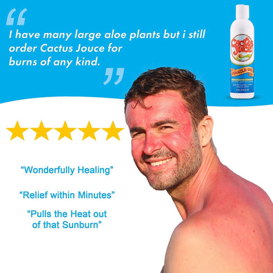 Sunburn Special